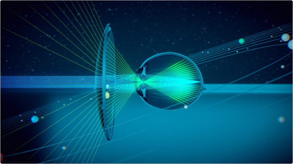 Lente Stellest — tecnologia ottica avanzata